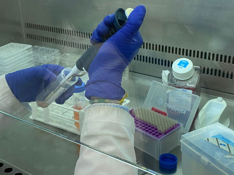 LIDIA LIZBETH INVESTIGA CÓMO RECUPERAR LA COMUNICACIÓN ENTRE NEURONAS