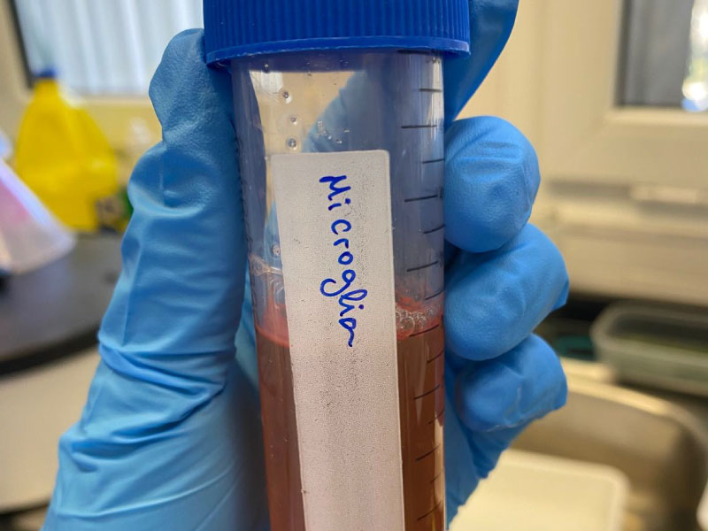 LIDIA LIZBETH INVESTIGA CÓMO RECUPERAR LA COMUNICACIÓN ENTRE NEURONAS